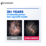 Men’s Rogaine Extra Strength 5% Minoxidil Topical Solution Hair Regrowth Treatment – (3-Month Supply) - Image 3